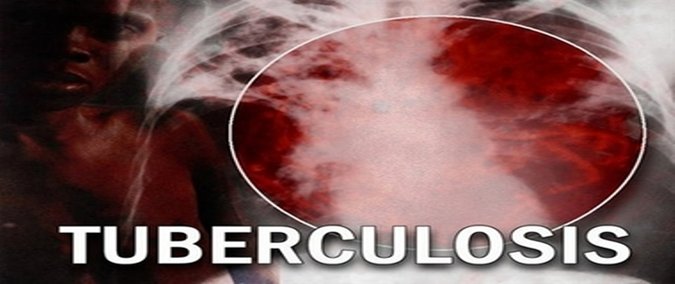 tuberculosis color